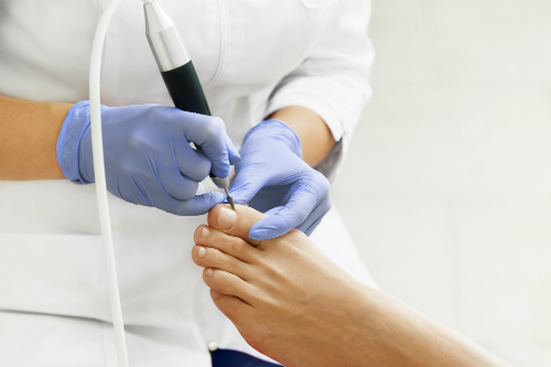 Evelynn Van Hautegem Kinesitherapeut – Medische pedicure
